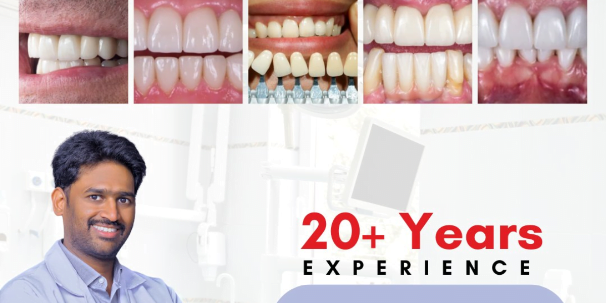 Transform Your Smile With Dr. Chandrahas, Dr. Chandrahas, premier specialist, Hyderabad